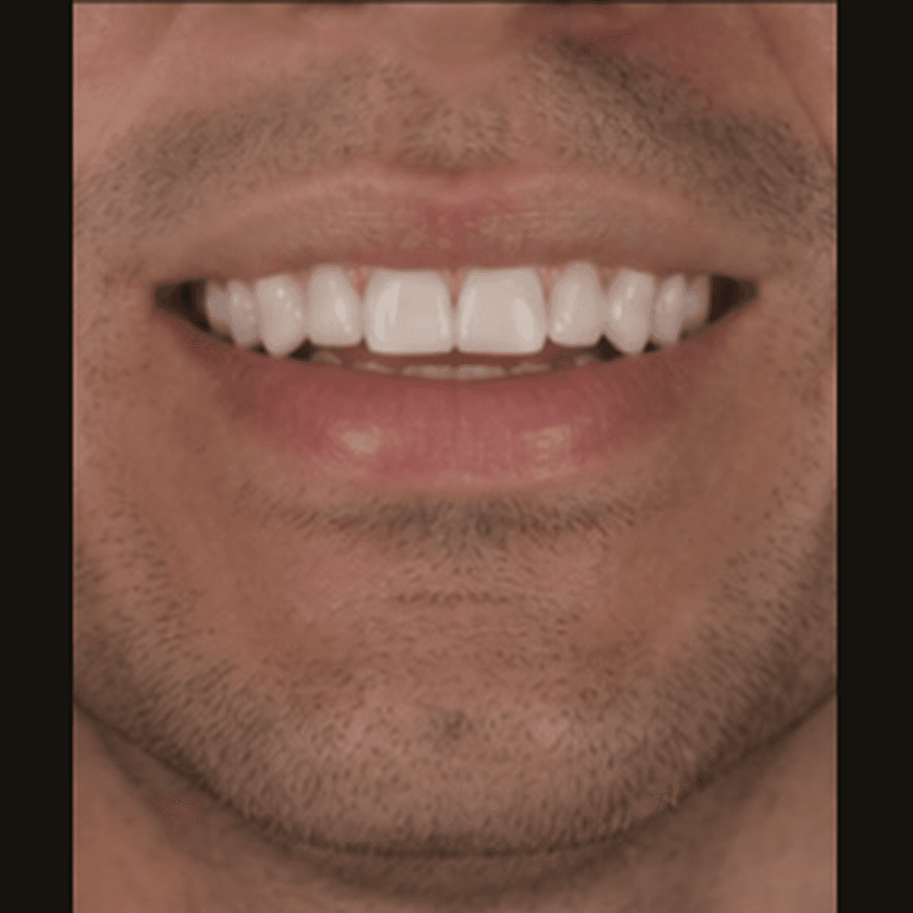 After treatment