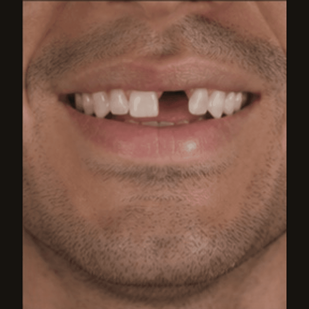Before treatment